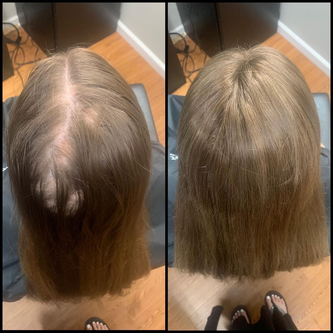 Top-down photos showing thinning hair and a widened scalp part before and after styling.