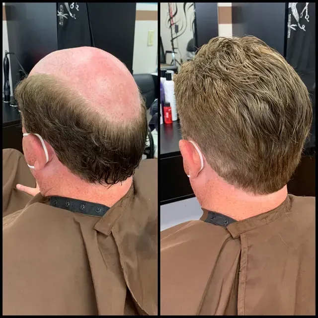 Split-screen of a barber's hair design transform: bald crown to blended short hairstyle