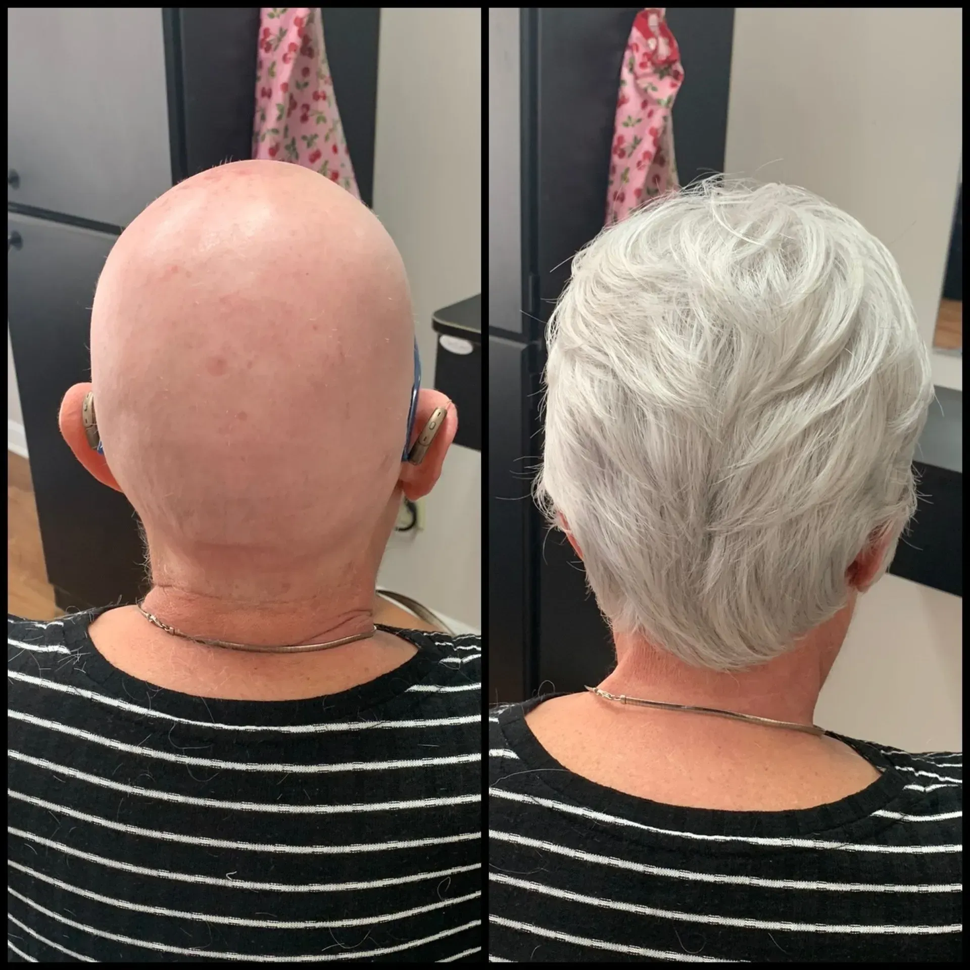 Back view of a bald head beside the same head with short silver hair in a side-by-side comparison
