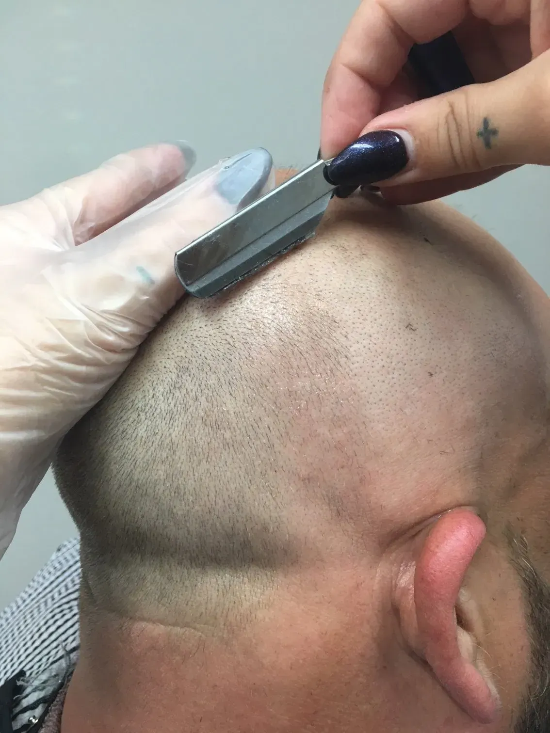 Gloved hand shaving a bald scalp with a razor, leaving short stubble on the head.