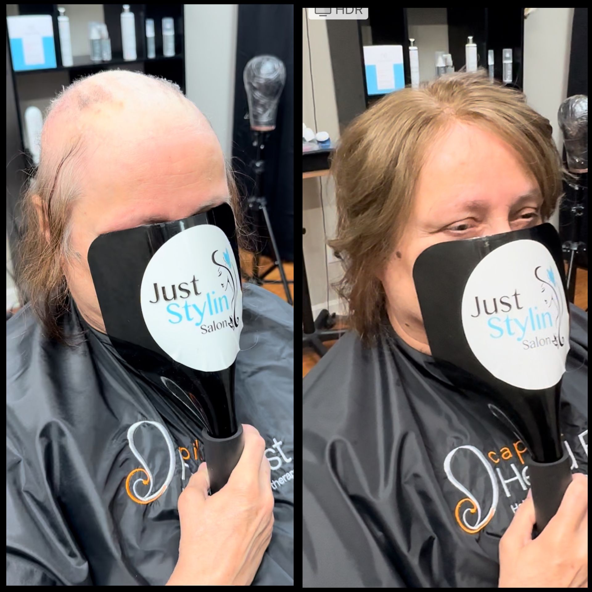 Before and after salon hair color transformation: bald crown to fuller blonde hair, side-by-side.