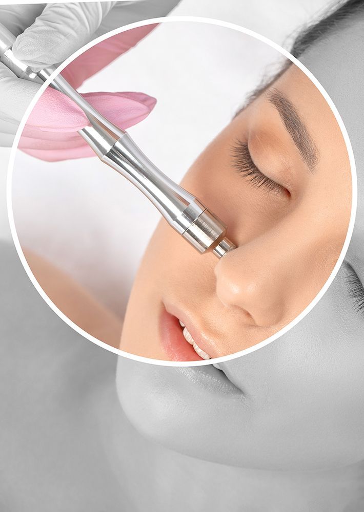 Cosmetic procedure with a handheld device applied to a woman's nose and cheek, shown in a circular close-up.