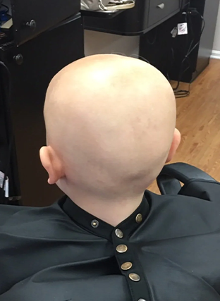 Back of a bald person seated in a black cape in a salon chair